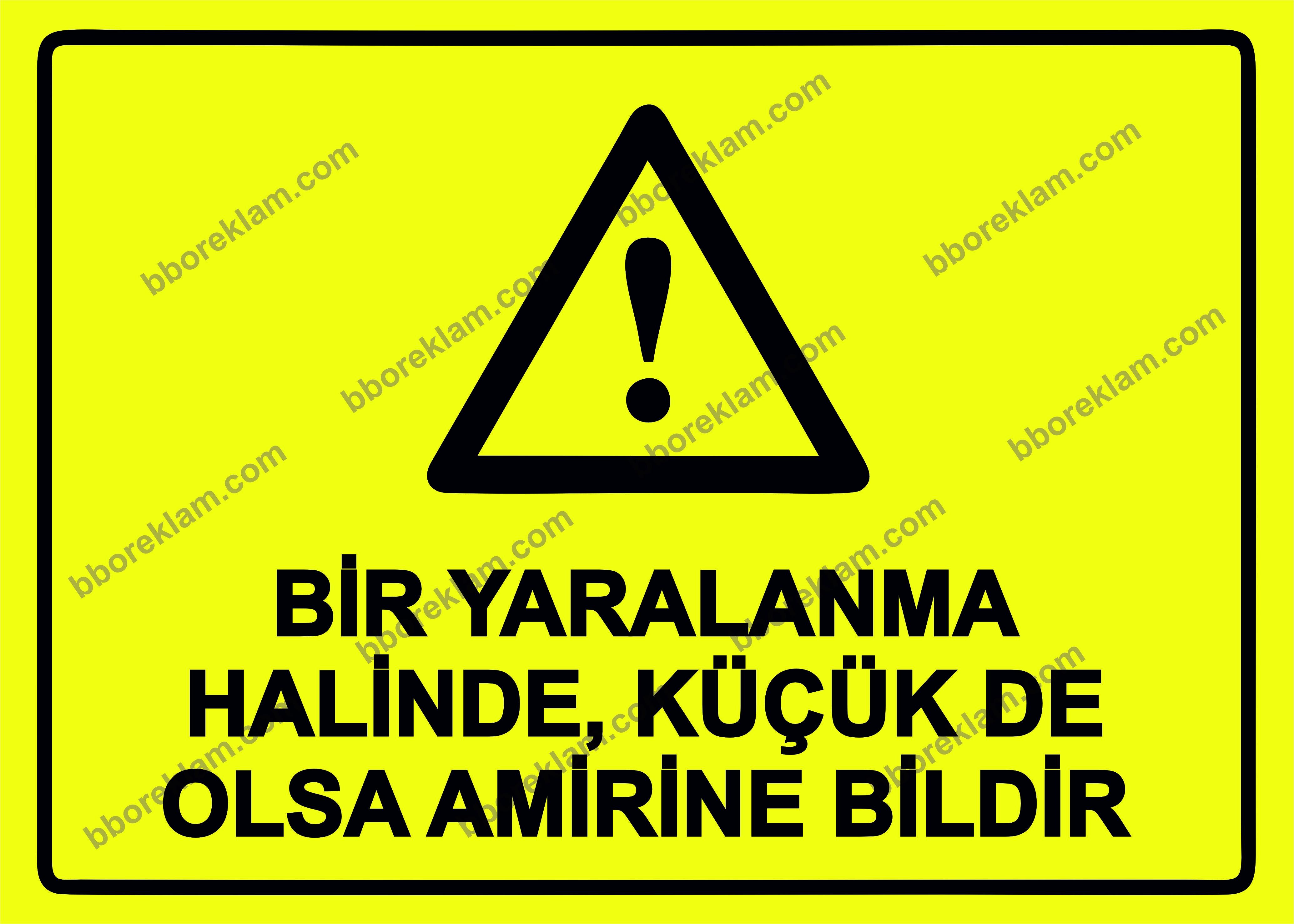 Bir Yaralanma Halinde, Küçük De Olsa Amirine Bildir Uyarı Levhası